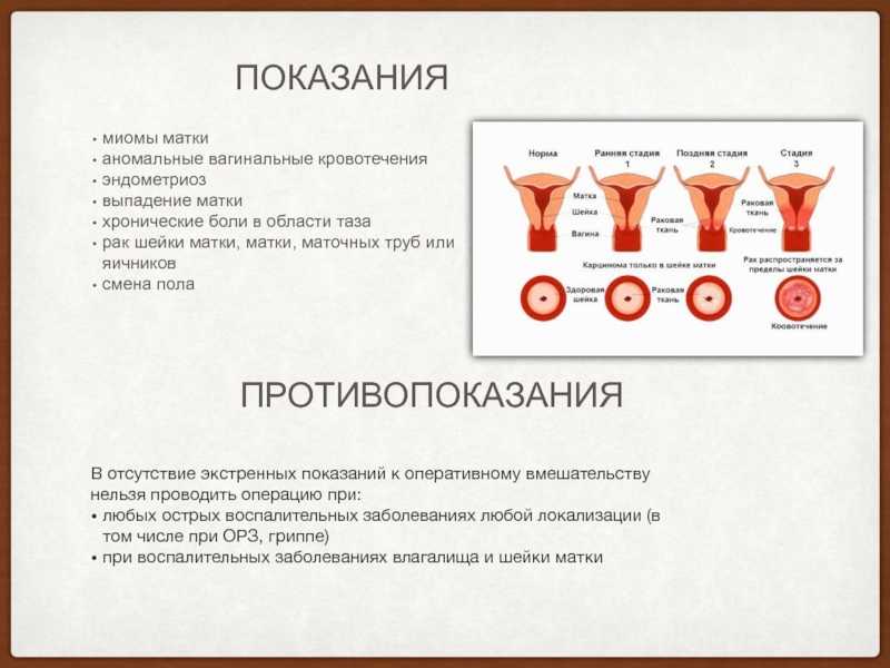 Меатомия — клиника "виромед"