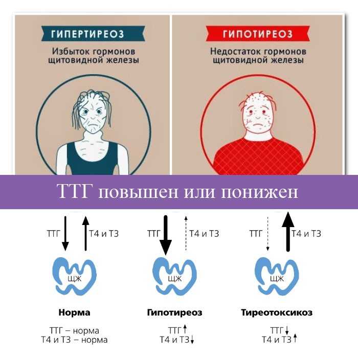 Топ 15 причин задержки месячных кроме беременности