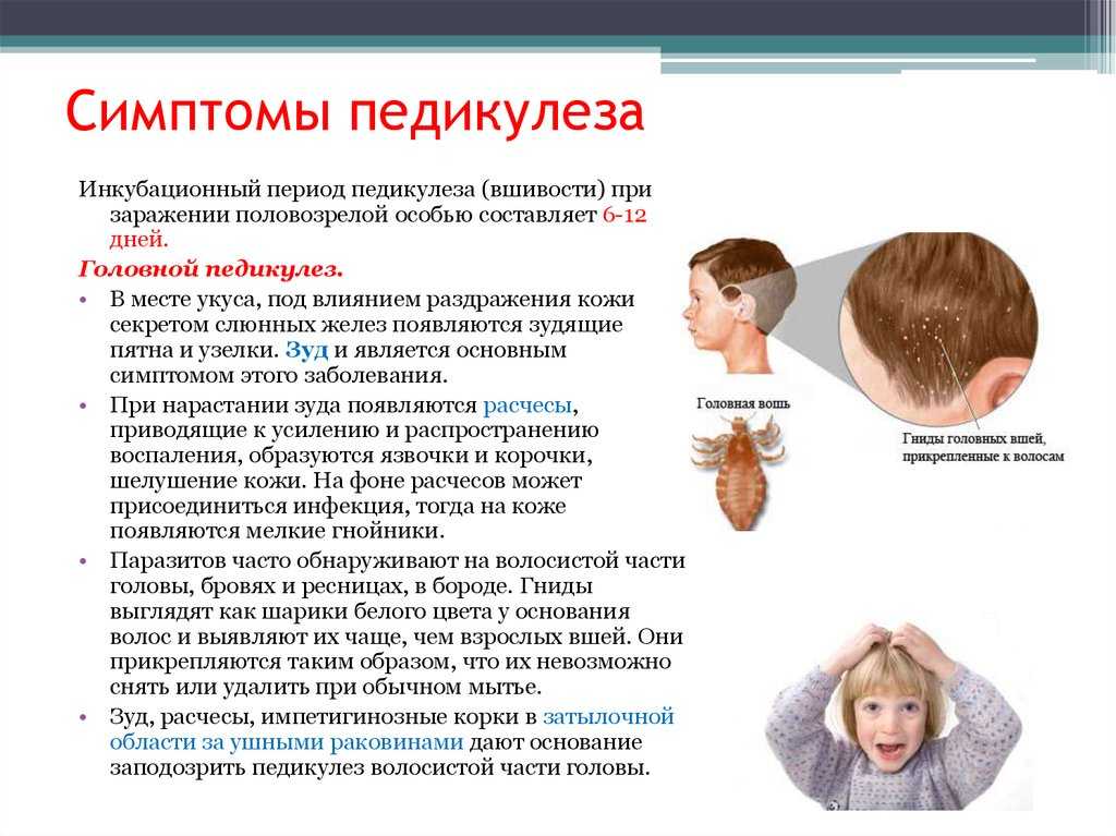 Вши у ребенка, взрослого: выбор средства от вшей, лечение педикулеза - напоправку – напоправку