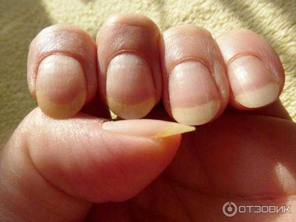 Как удалить кутикулу?