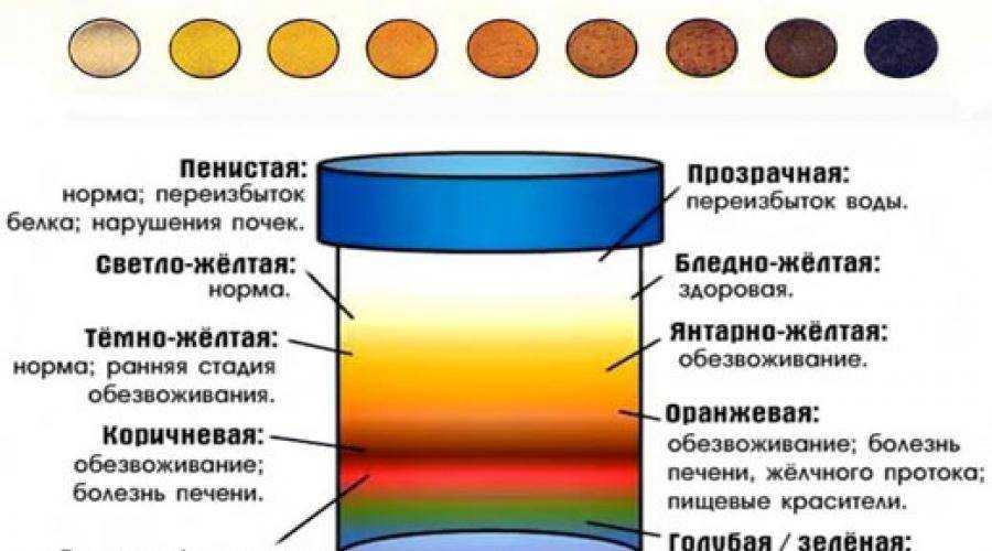 Изменение цвета мочи: причины у женщин, мужчин, ребенка | food and health