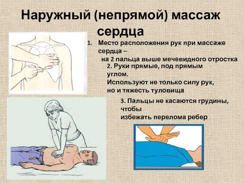 Массаж сердца и искусственное дыхание: техника закрытого и открытого массажа