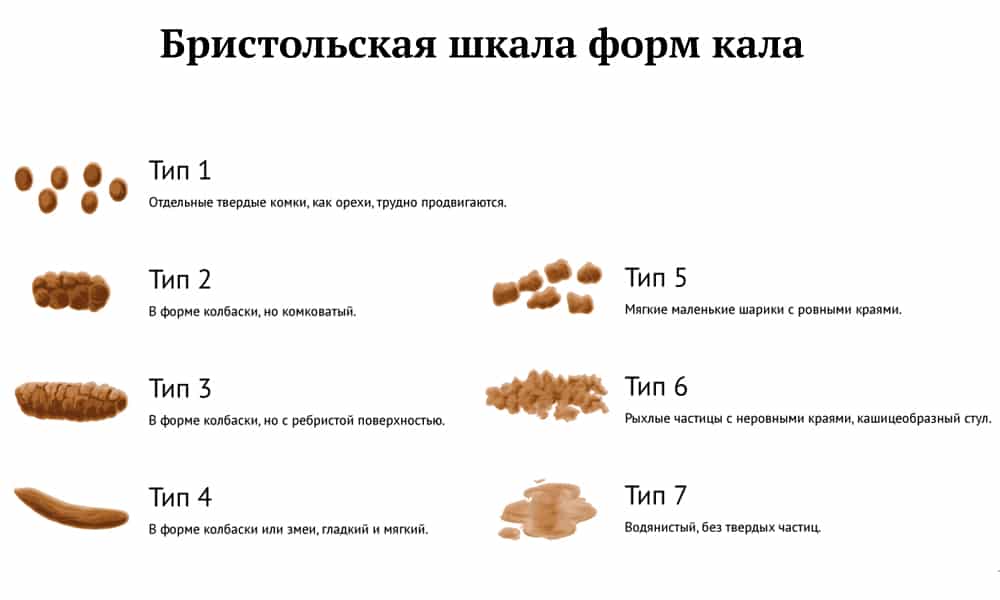 Зачем делают копрограмму? цель процедуры и расшифровка результатов