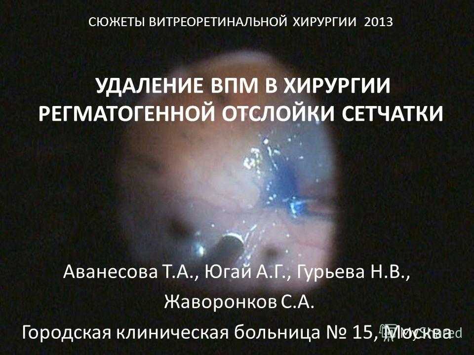 Основные методы восстановления зрения