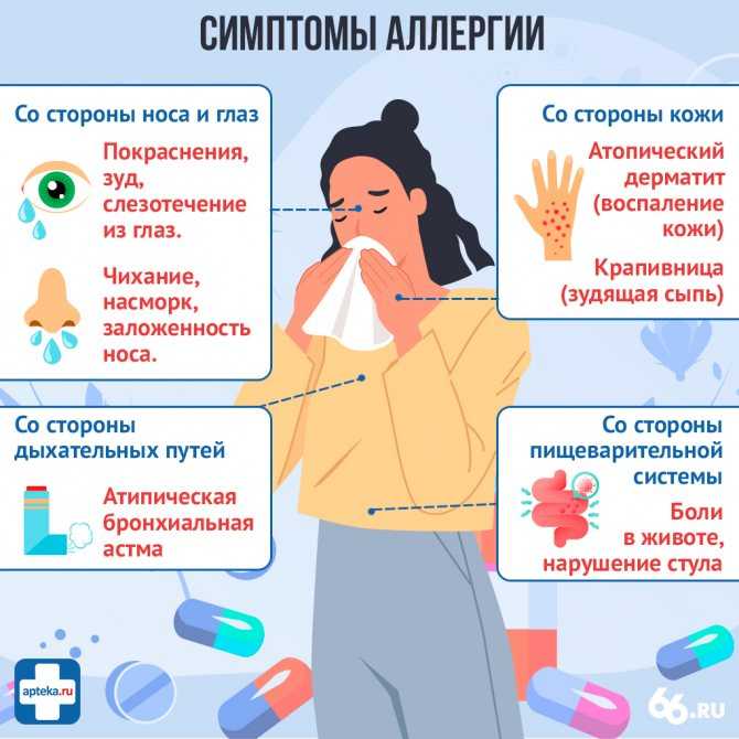 Аллергия на кошачьих и её симптомы