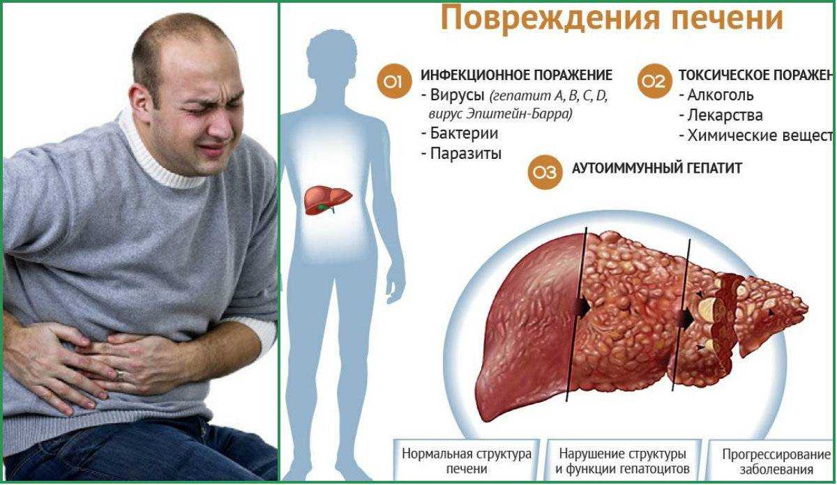 Почему печень вырабатывает много плохого холестерина?