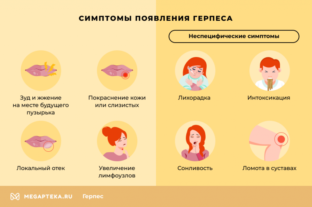 Какая ж ты зараза: что делать с герпесом на губах