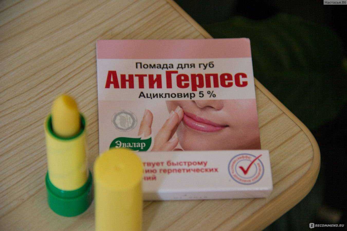 Какая ж ты зараза: что делать с герпесом на губах