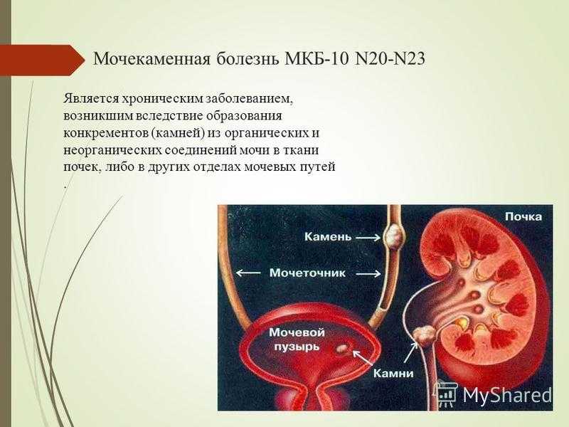 Признаки заболевания почек у женщин: симптомы и лечение