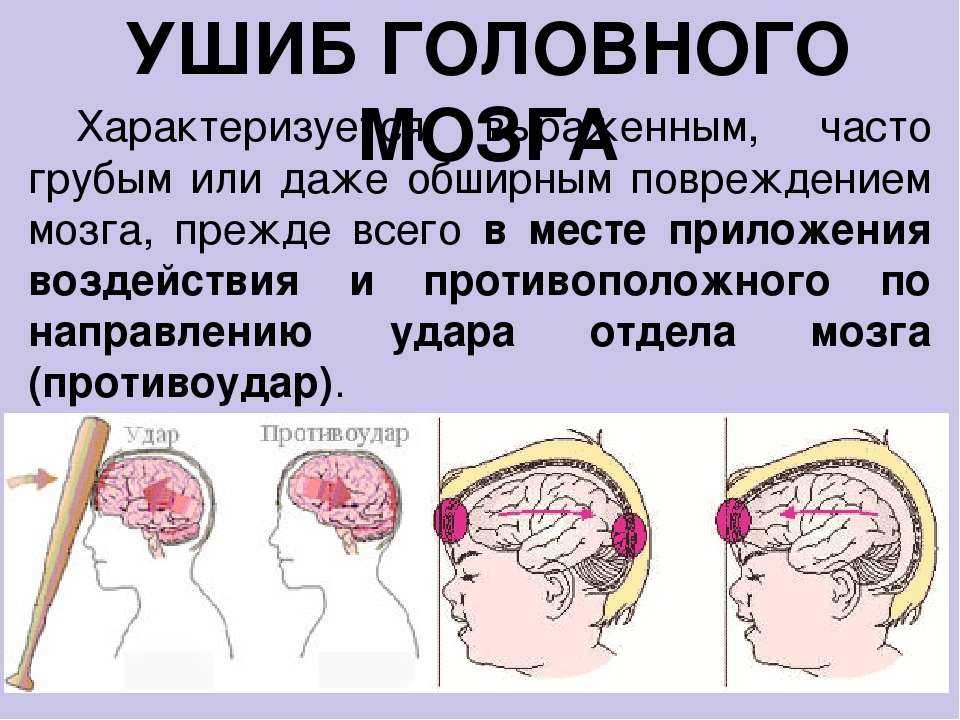 Сотрясение мозга до года. Сотрясение головы у ребенка. Сотрясение головы и головного мозга.