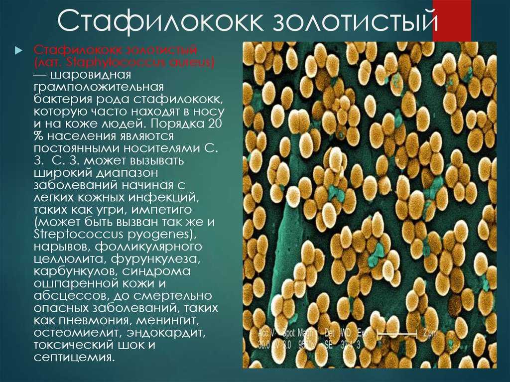 Стафилококк - частая больничная инфекция