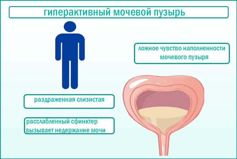 Мочеиспускание с кровью у мужчин причины