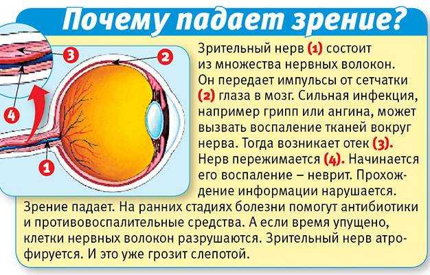 Основные причины ухудшения зрения в современном мире