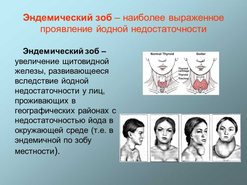 Заболевания щитовидной железы госпитальная хирургия презентация