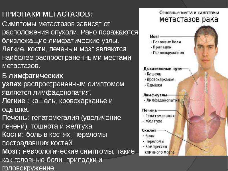 Лейкоз (лейкемия, рак крови)