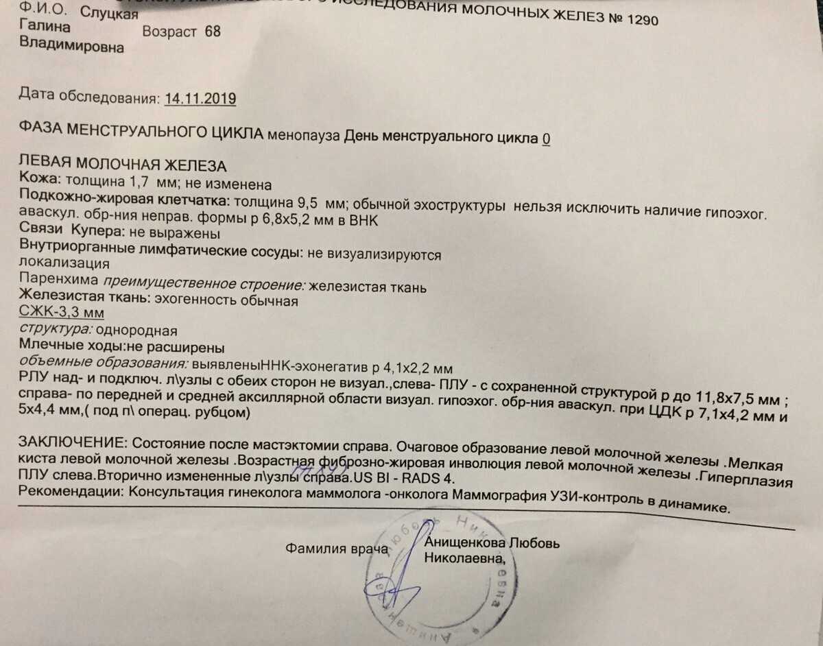 Узи молочных желез | когда делать узи молочных желез «омикрон - томоград»