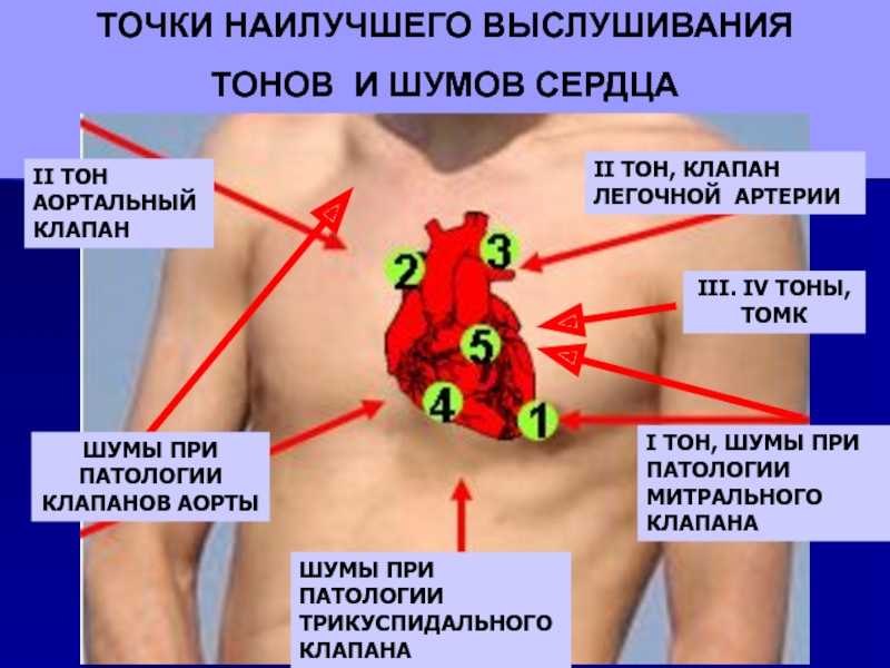 Точки аускультации сердца рисунок