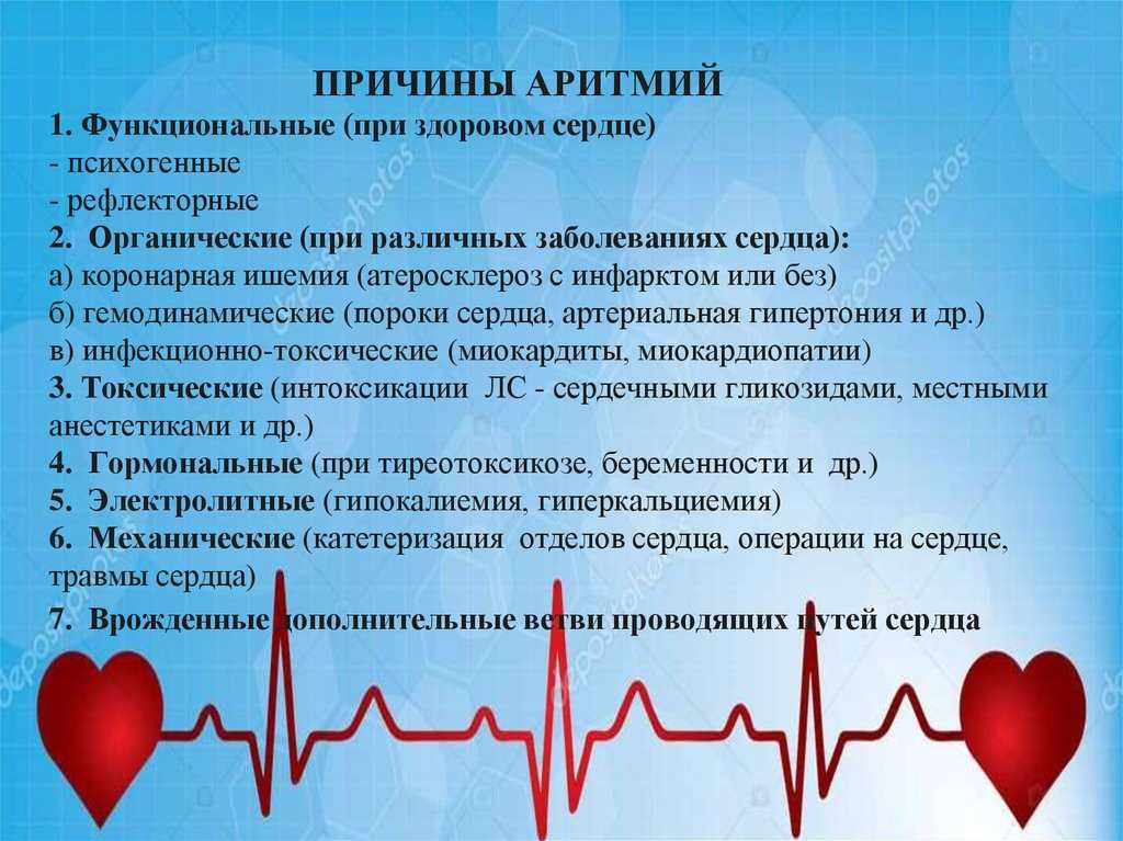 Тахикардия, виды тахикардии, причины, признаки, диагностика, симптомы, лечение