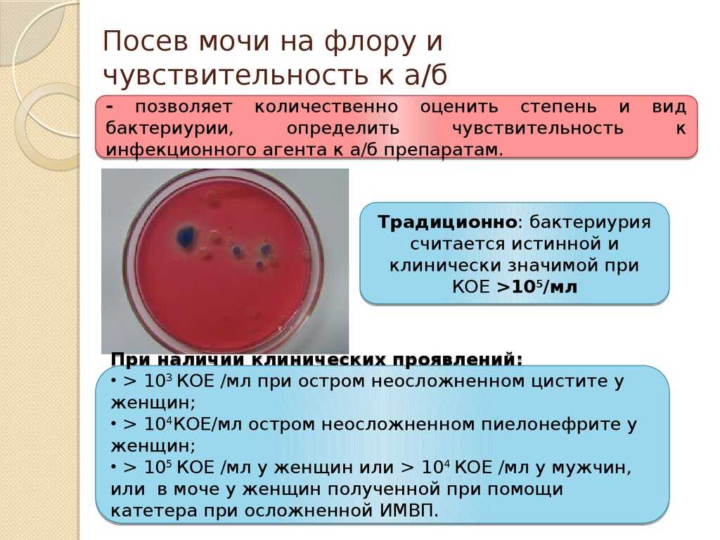 Бакпосев мочи
