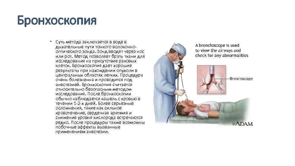 Бронхоскопия легких: что это такое, видео как проходит и как делают диагностическую фибробронхоскопию под наркозом, что показывает эндоскопия бронхов и ее виды