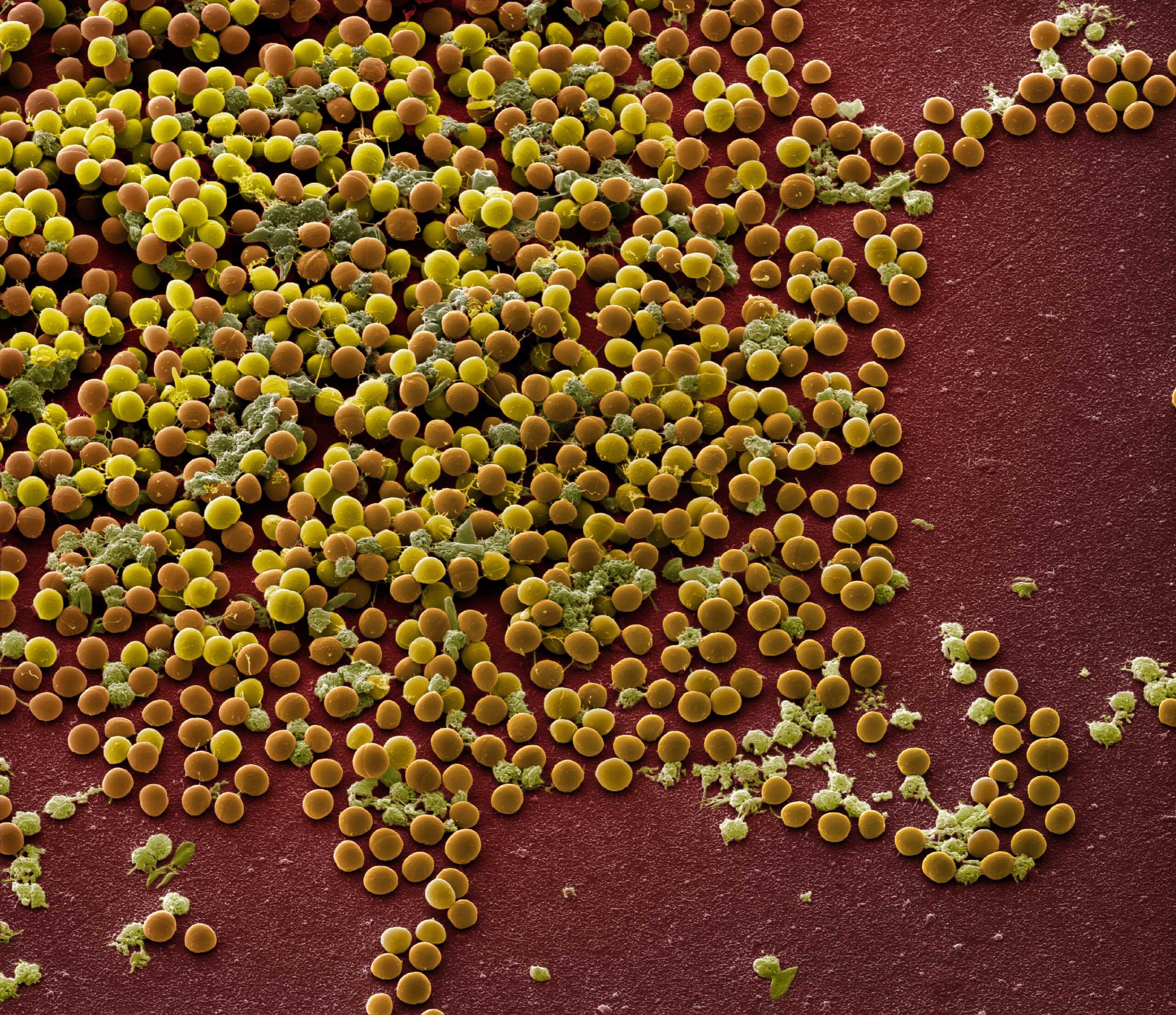 Enterococcus faecalis энтерококк фекальный в мазке у женщин