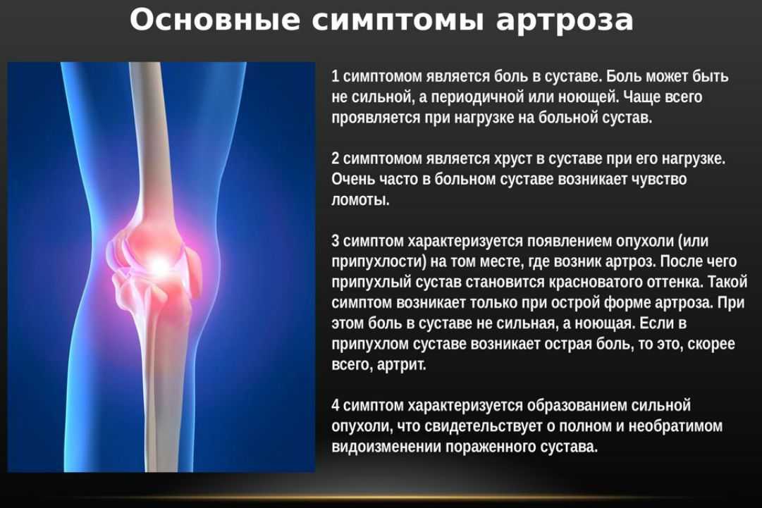 Воспаление суставов: бурсит и синовит