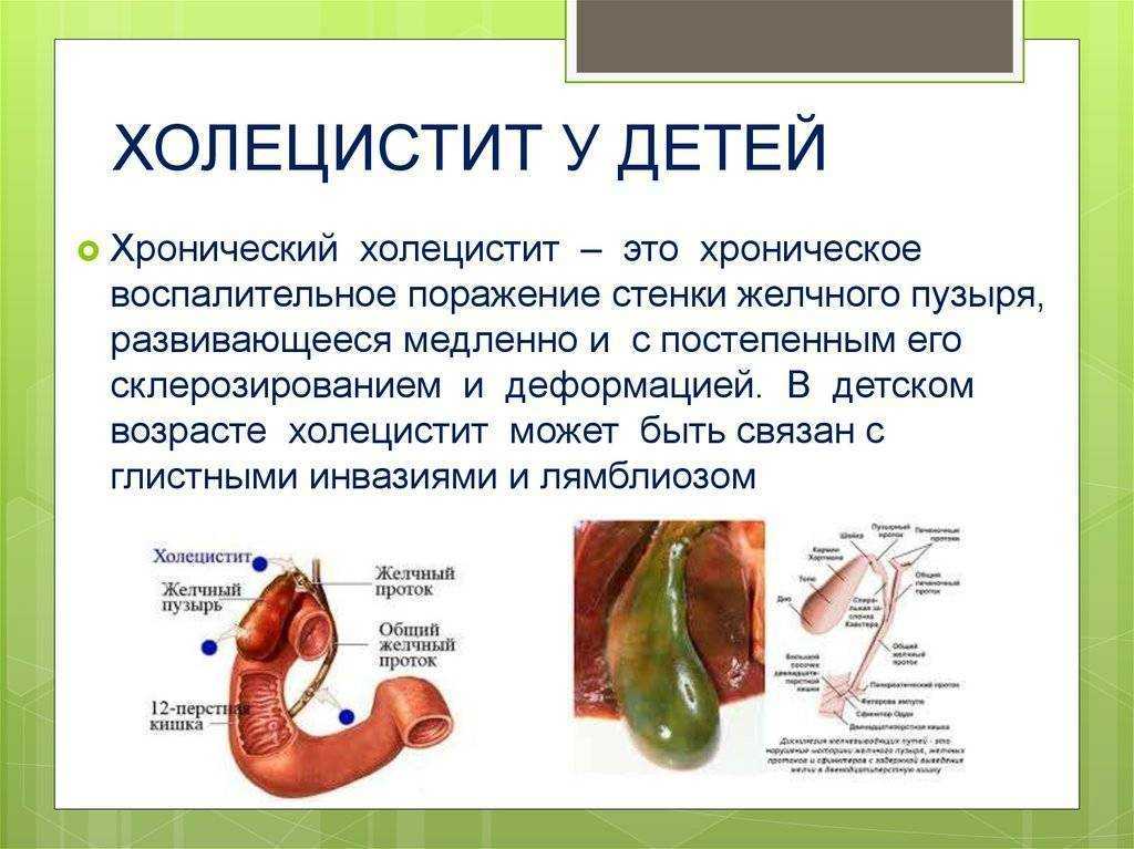 Боли в желчном пузыре - причины и лечение