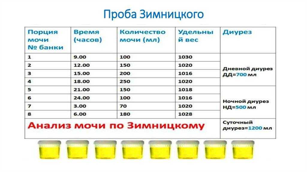 Анализ мочи по зимницкому