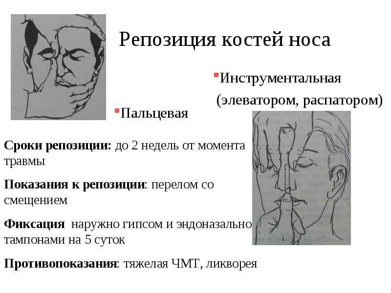 Что делать при травме глаза