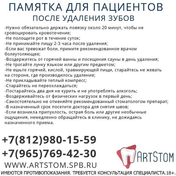 Подготовка к имплантации зубов: что необходимо знать перед операцией?