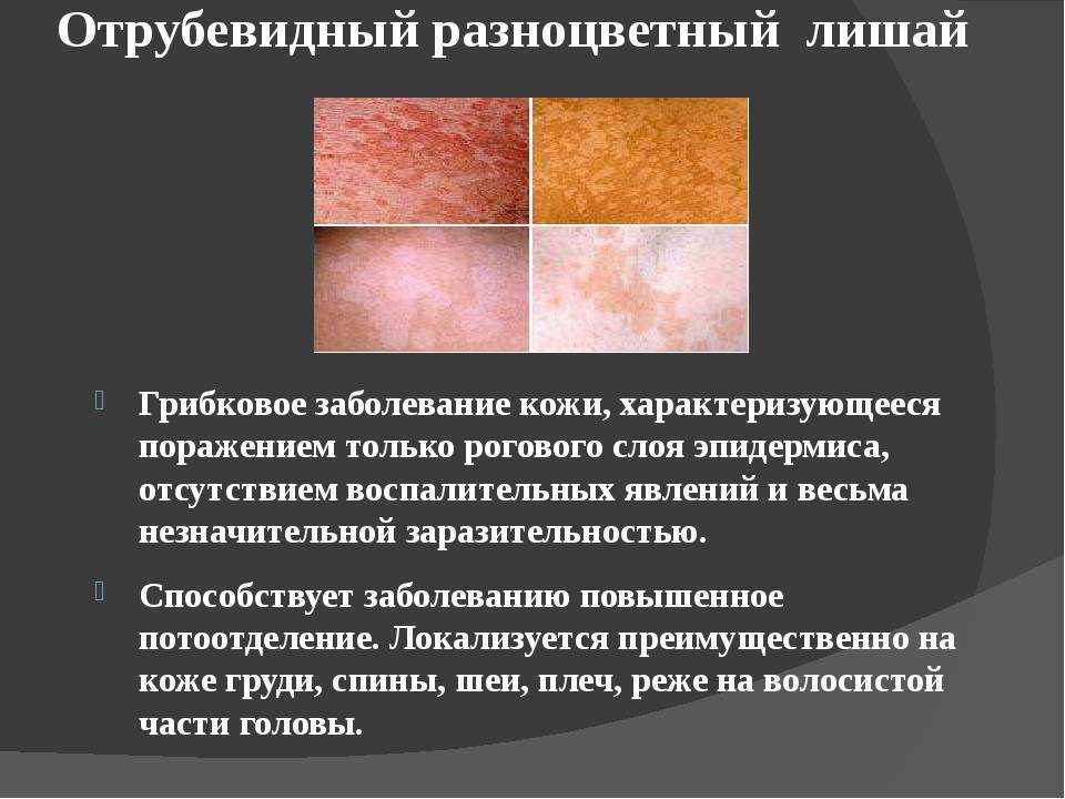 Можно ли заразиться через одежду и полотенца?