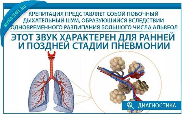 Крепитация и мелкопузырчатые хрипы. Крепитация. Для какого заболевания характерна крепитация. Крепитация характерна для. Крепитация в легких.