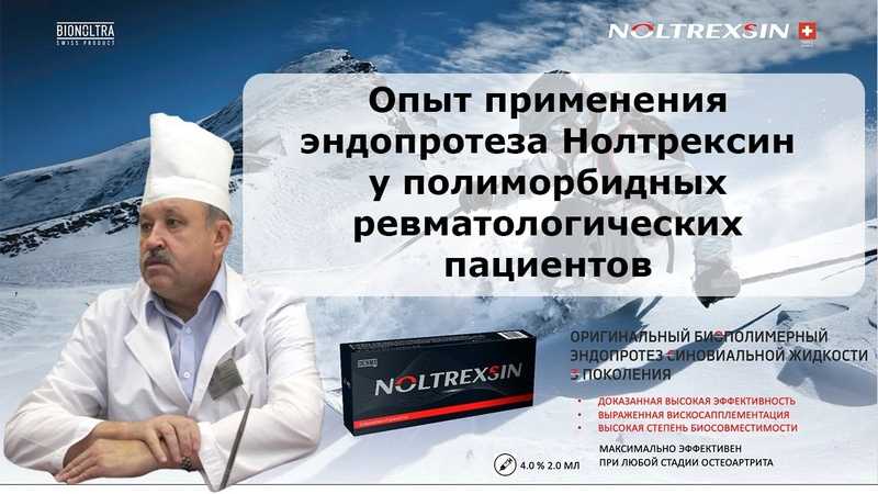 Первичный прием врача-ревматолога: осмотр, консультация | услуги клиники «проксима» (г. сочи)