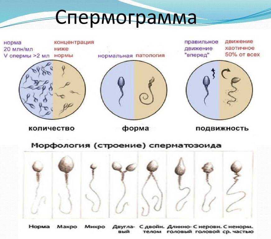 Как сдать спермограмму: показания, подготовка, проведение