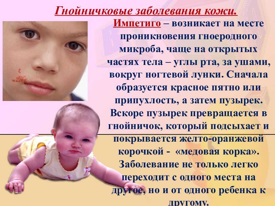 Паразитарные болезни кожи | eurolab | научные статьи