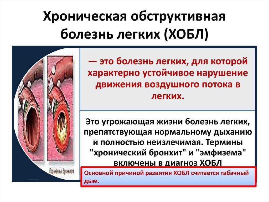 Хроническая обстркутивная болезнь лёгких (хобл)