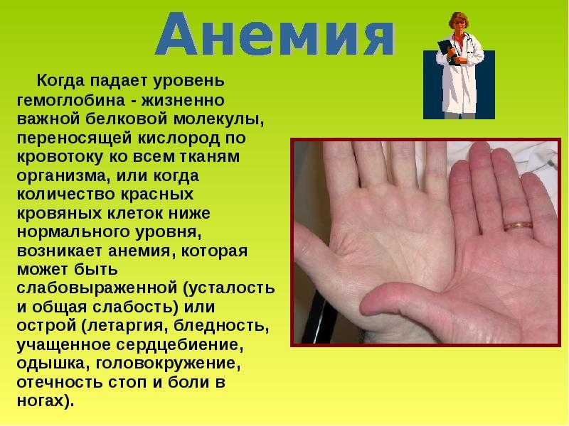 Низкий гемоглобин(анемия) - кировский центр крови