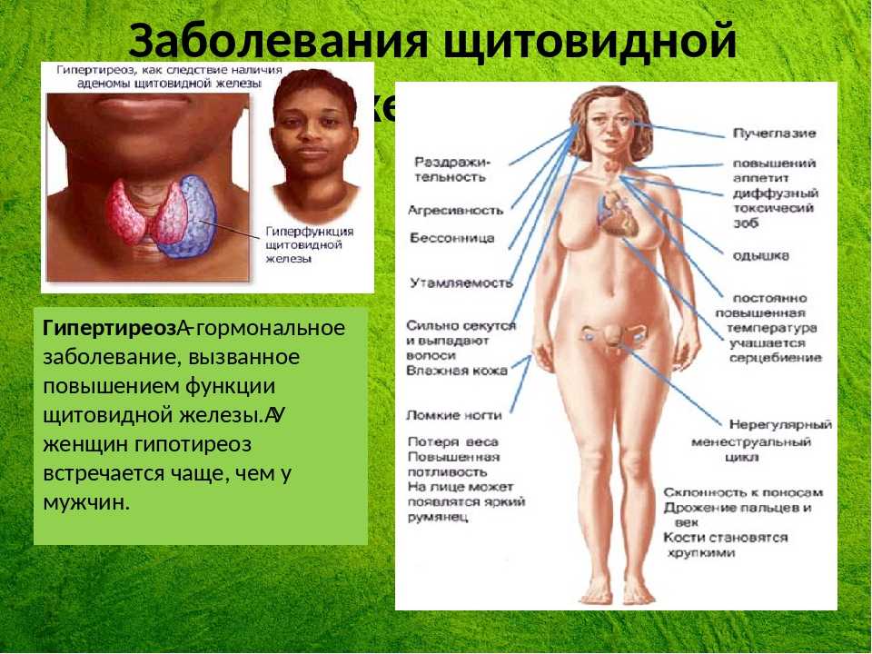 Верхний референсный уровень ттг - достаточно ли аргументов для его изменения | фадеев | проблемы эндокринологии