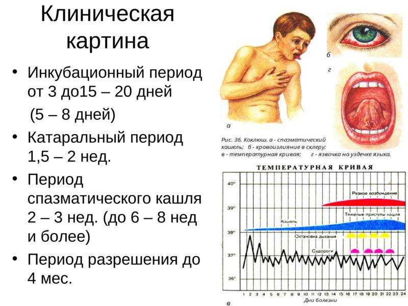 ᐈ как разпознать коклюш? ~【диагностика в киеве】