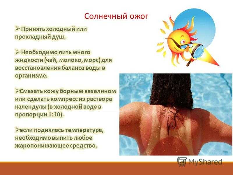 Солнечный ожог.первая помощь | гбуз республики крым