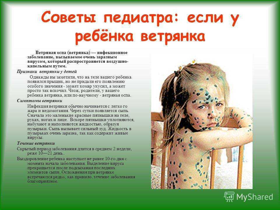 Прививка от полиомиелита детям: можно ли делать ребенку