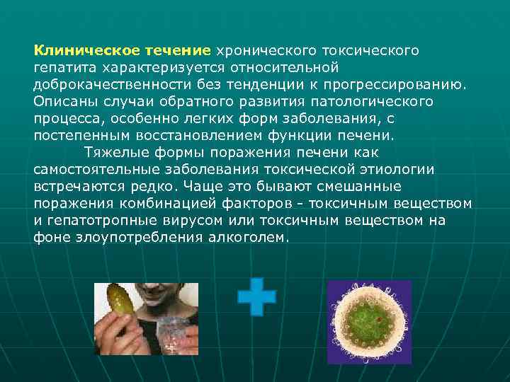 Гепатит алкогольный