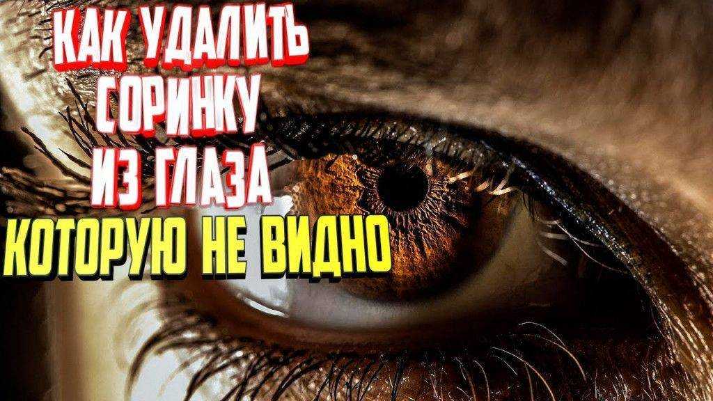 Удаление инородного тела из глаза - кгбуз горбольница №12
