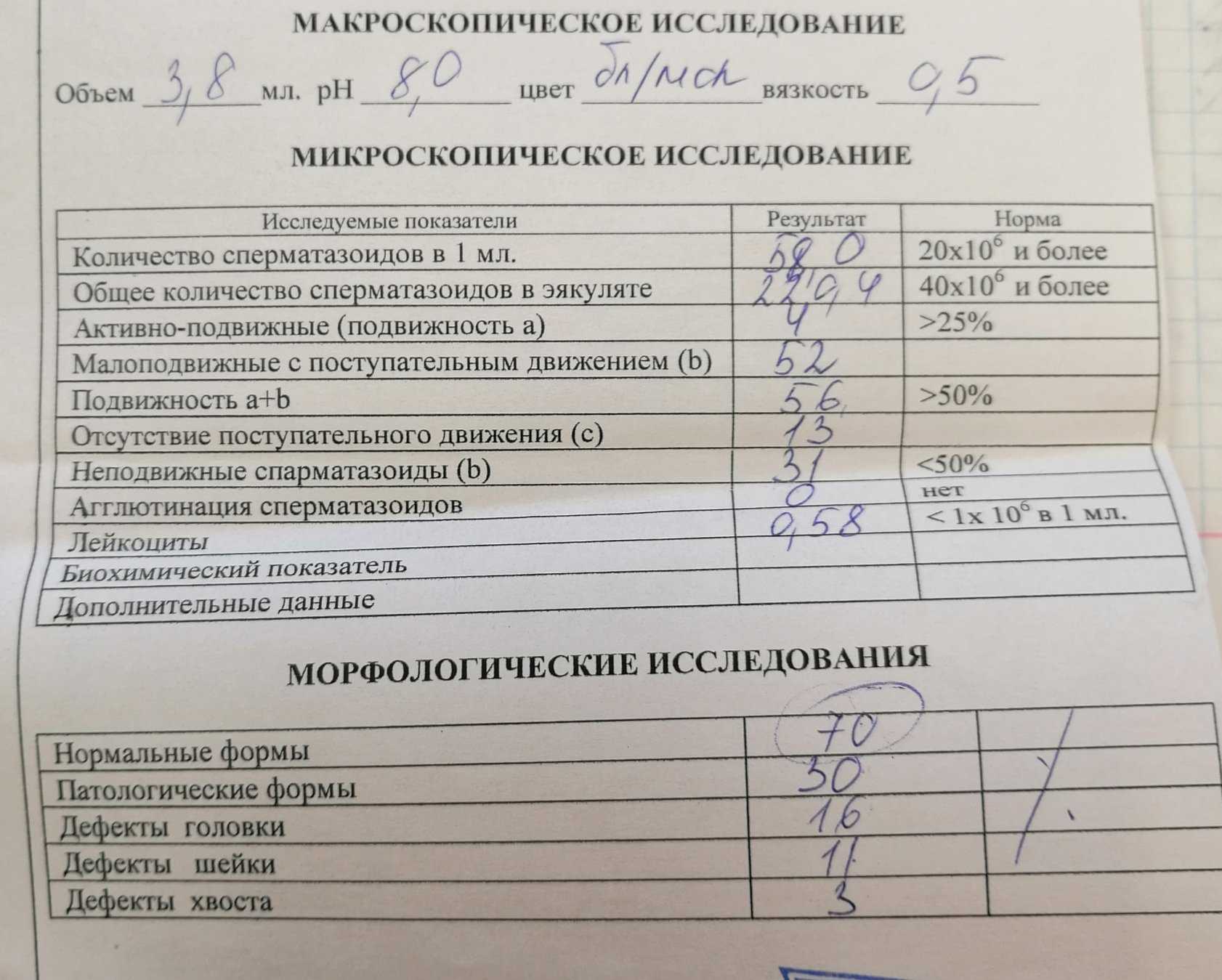 Мужское бесплодие: что покажет спермограмма