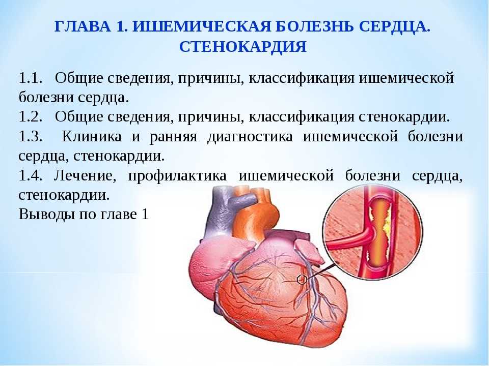 Ишемический сердца. Ишемическая болезнь сердца (ИБС). Ишемическая болезнь сердца стенокардия инфаркт миокарда. Ишемическая болезнь сердца презентация.