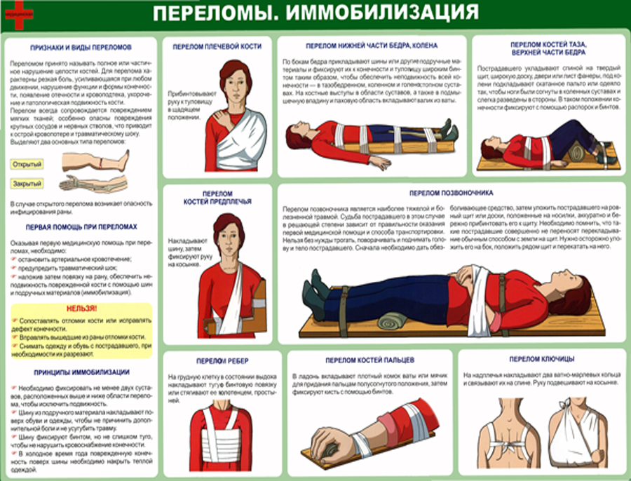 Оказание первой помощи при переломах план урока