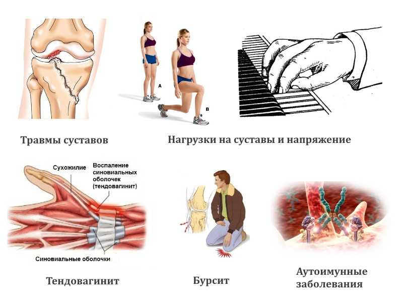 Гигрома