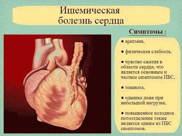 Ишемическая болезнь: виды, симптомы, лечение, осложнения