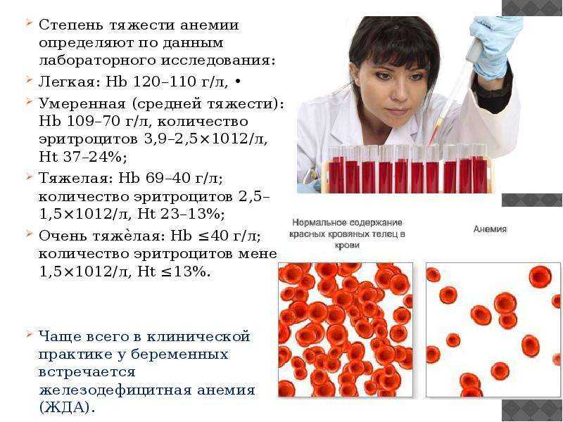 Анемия: что это такое, признаки и симптомы, лечение