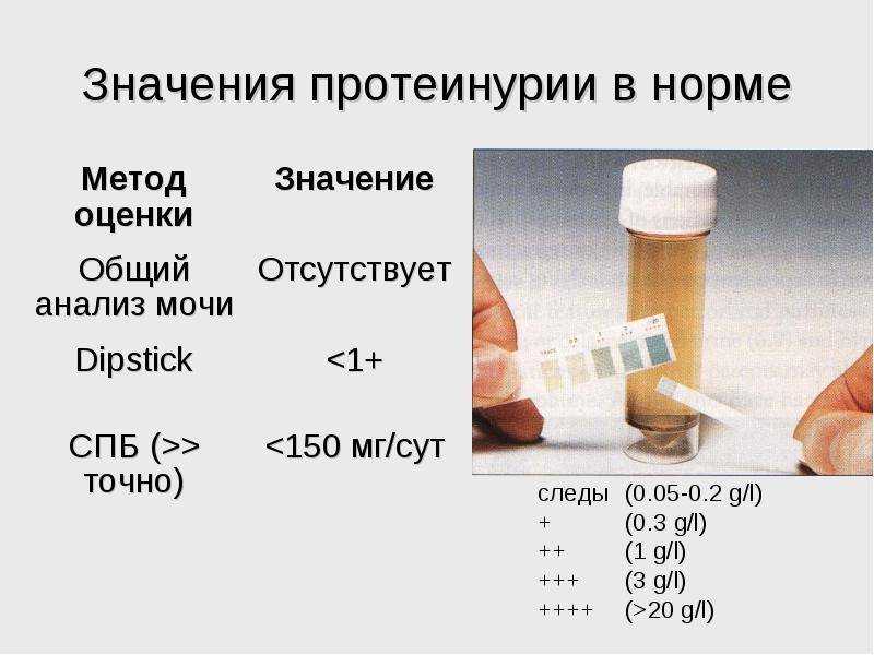 Белок в моче (протеинурия): причины, факторы риска, влияние на беременность